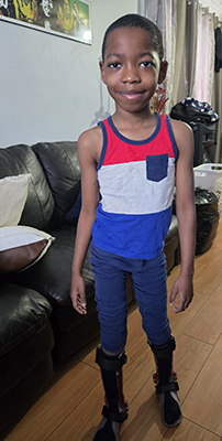 Kae wearing his braces.